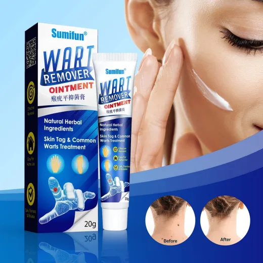 Κρέμα αφαίρεσης μυρμηγκιών Wart Remover
