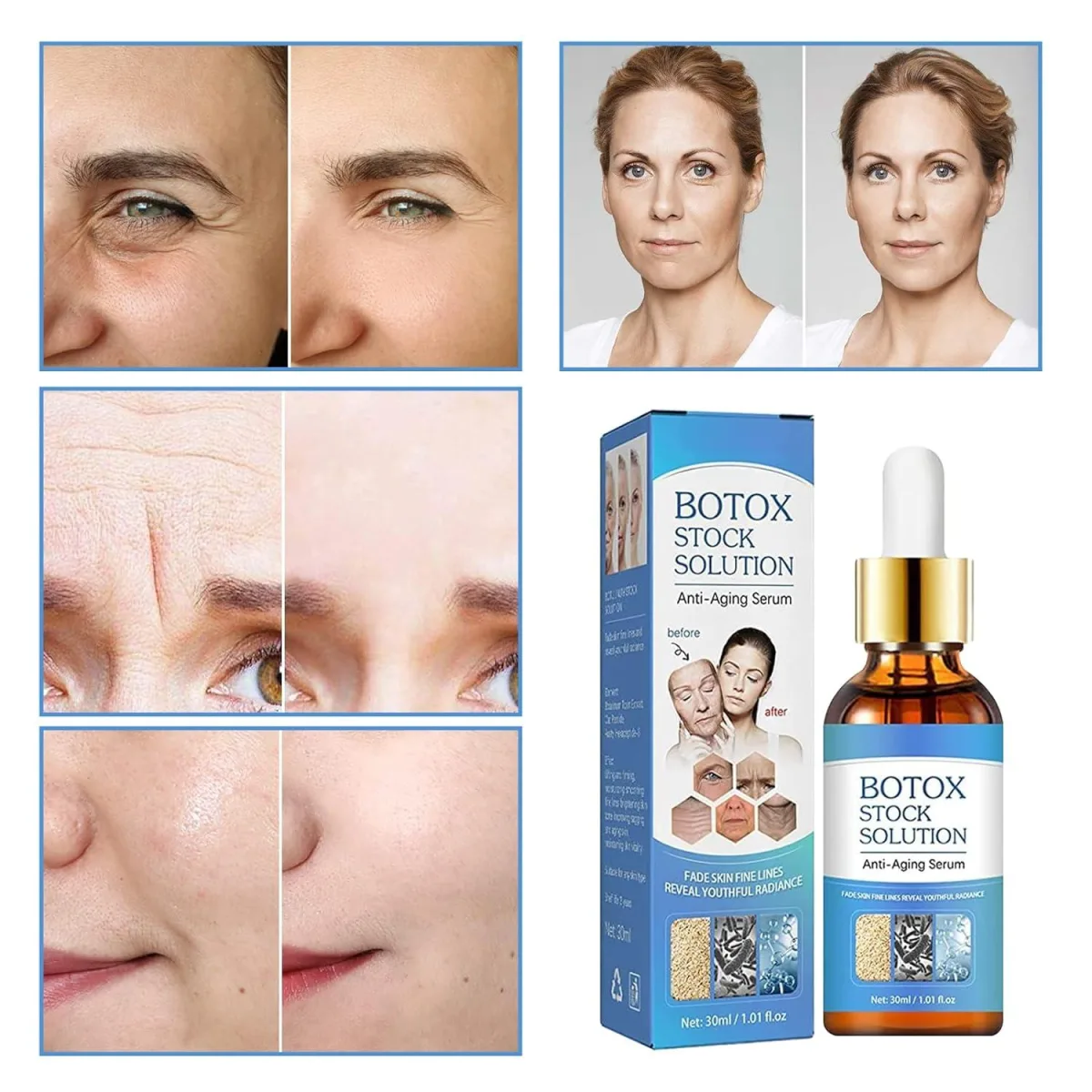 Αντιρυτιδικός ορός προσώπου Botox Stock Solution 30ml