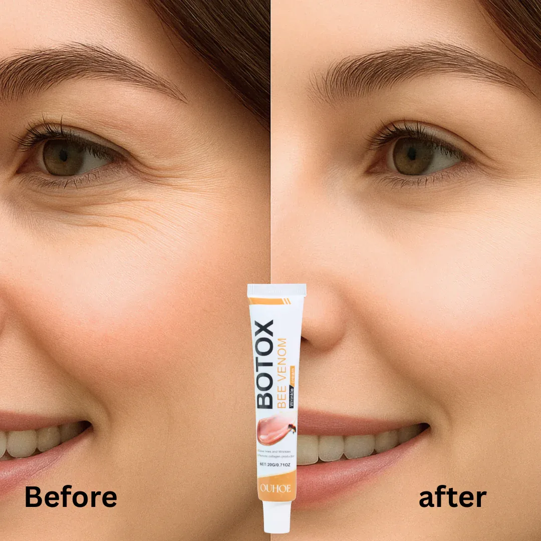 Αντιρυτιδική κρέμα με δηλητήριο μέλισσας BOTOX Bee Venom, 20 g