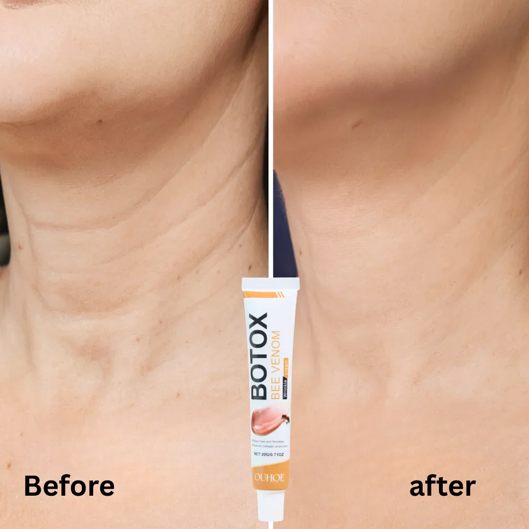 Αντιρυτιδική κρέμα με δηλητήριο μέλισσας BOTOX Bee Venom, 20 g