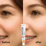 Αντιρυτιδική κρέμα με δηλητήριο μέλισσας BOTOX Bee Venom, 20 g