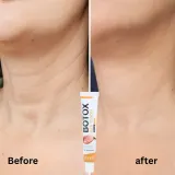 Αντιρυτιδική κρέμα με δηλητήριο μέλισσας BOTOX Bee Venom, 20 g