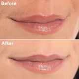 Συσκευή αποτρίχωσης προσώπου Flawless Finishing Touch