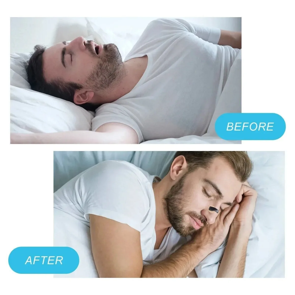 Μαγνητικός ρινικός διαστολέας Premier Nasal Dilator